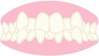 Occlusion Dentaire Pour la Sante