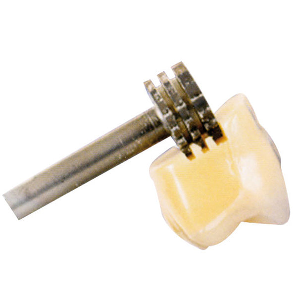 Brocas de carboneto de tungstênio - Para  Retenção Rápida  dos Dentes.