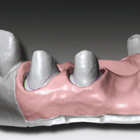 Gingifast CAD starre Zherkt 2x50 ml - Für falsche Zahnfleisch Zherkt.