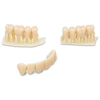 Résine Dima Print Denture Teeth Kulzer - Impression Couronnes Bridges.